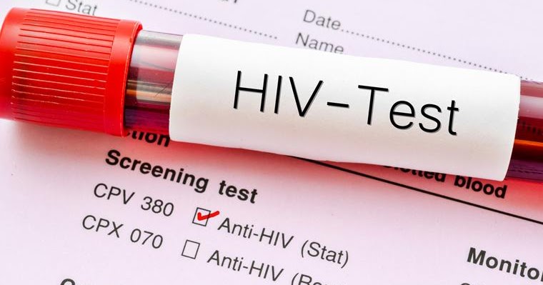Spread of HIV/AIDS: CSOs call for serious, broader public sensitization