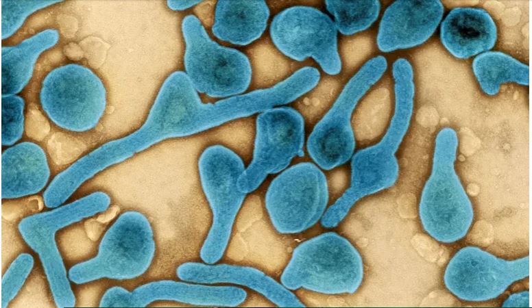 WHO Confirms Outbreak of Deadly Marburg Disease in Equatorial Guinea