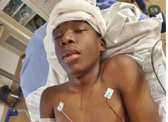 White Man Shoots Black Teen In The Head For Wrongly Ringing His Door Bell
