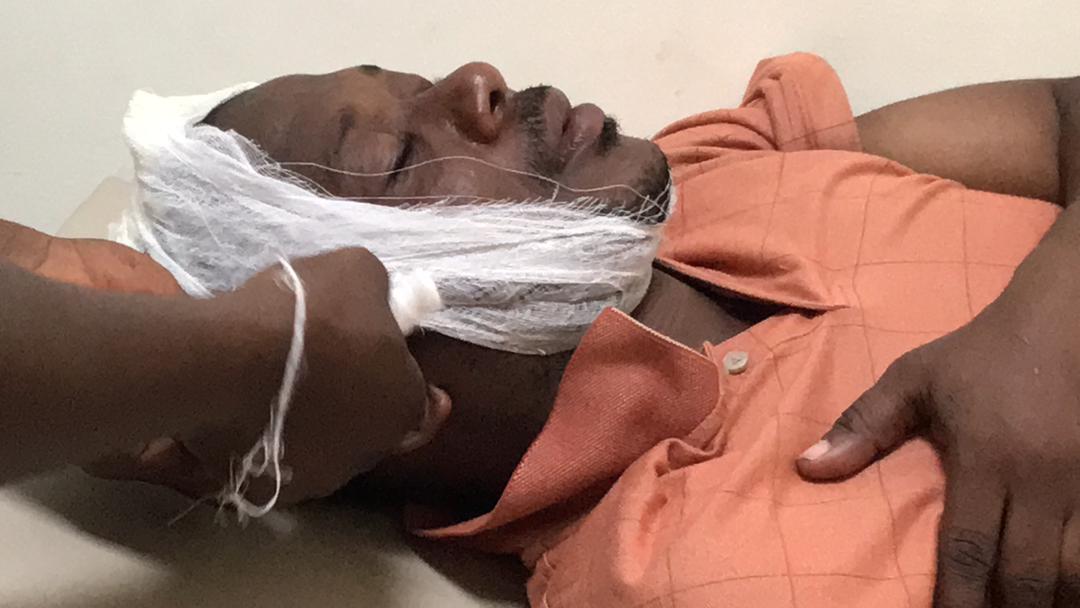 Medical doctor beaten to pulp by ECG staff at Nyanyano Kakraba