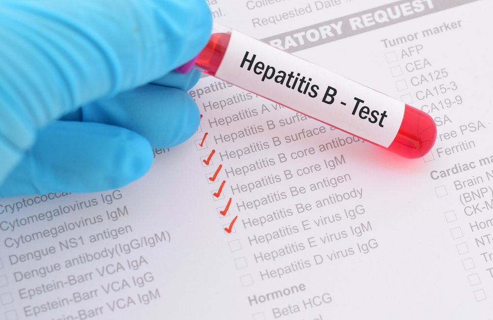 Hepatitis B infections rising in Efutu Municipality